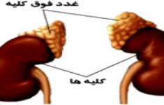 مسابقه اعصاب و غدد2
